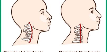 Douleurs cervicales, torticolis, maux de tête...